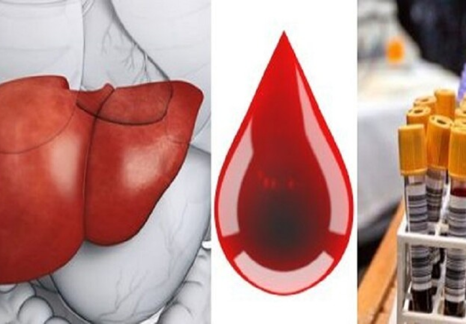علماء يبتكرون أسلوبا لاكتشاف سرطان الكبد بناء على قطرة دم واحدة