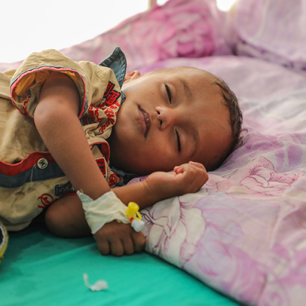 تحذير أممي من سوء التغذية الحاد يهدد حياة أطفال اليمن